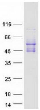 Coomassie blue staining of purified PDCD1 protein.